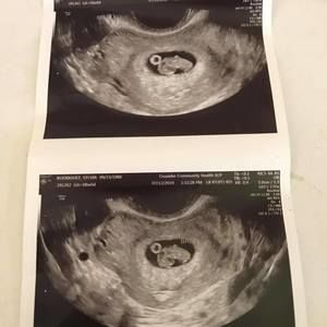 Meet your Posher, Sylvia